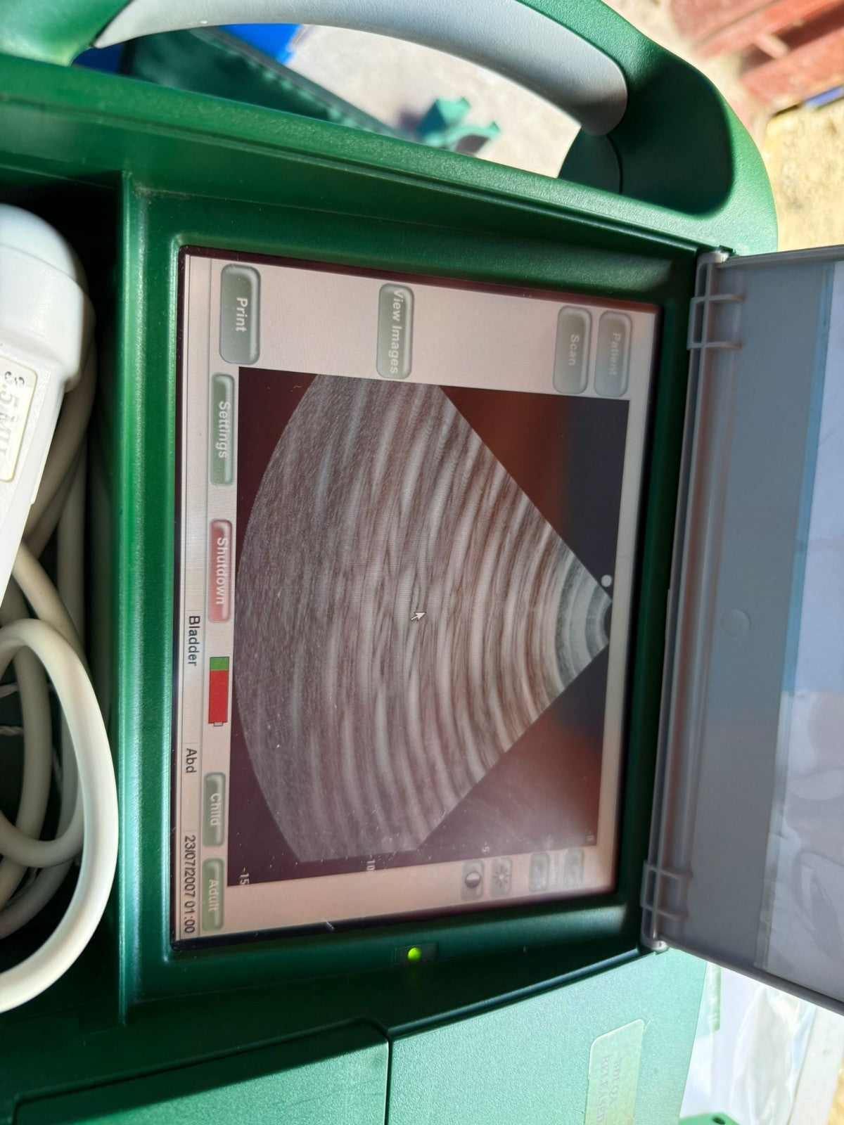 BARDSCAN IIs ULTRASOUND BLADDER SCANNER UROLOGY +2x NIMH BATTERY and case